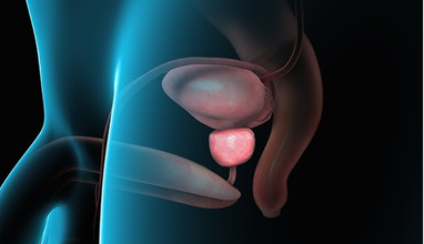 What Is an Enlarged Prostate? — Urocare Hospital Gondia