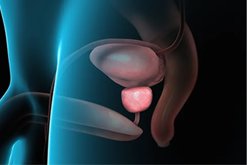 What Is an Enlarged Prostate? - Urocare Hospital Gondia