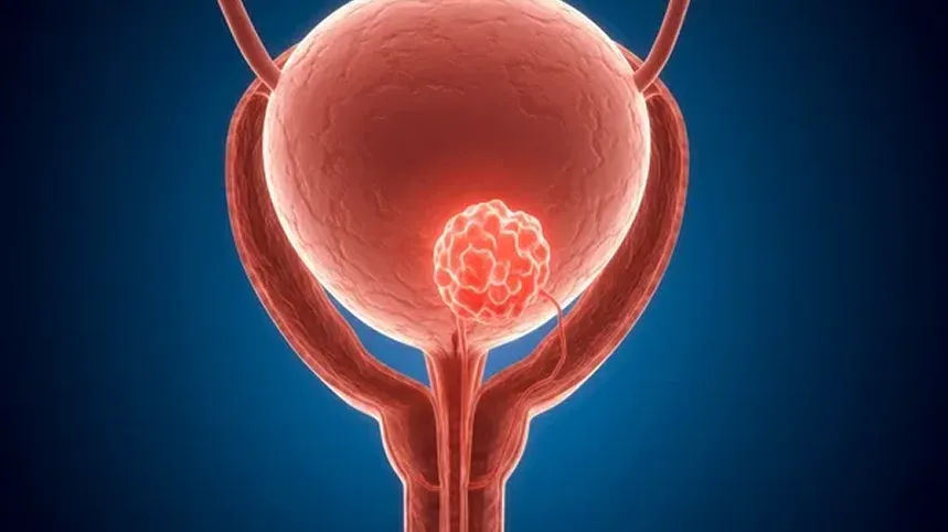What Is Reconstructive Urology? - Urocare Hospital Gondia