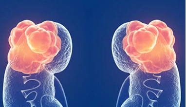 Why Early Evaluation Matters — Urocare Hospital Gondia