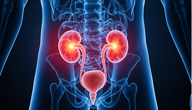 What Is a Urinary Tract Infection? — Urocare Hospital Gondia